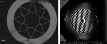 A team of researchers at Heriot-Watt University and the University of Bath have described two silica hollow-core microstructured fiber designs – negative-curvature fiber (a) and photonic-bandgap fiber (b) – that can help to advance mid-IR laser surgery applications.