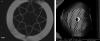 A team of researchers at Heriot-Watt University and the University of Bath have described two silica hollow-core microstructured fiber designs – negative-curvature fiber (a) and photonic-bandgap fiber (b) – that can help to advance mid-IR laser surgery applications.